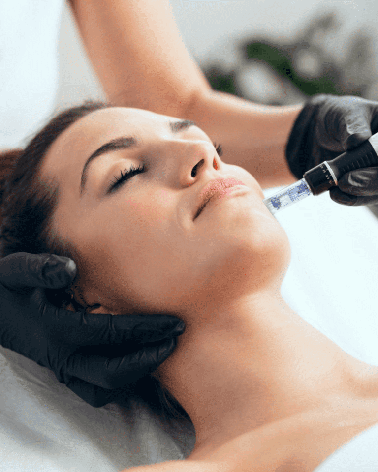 Microneedling